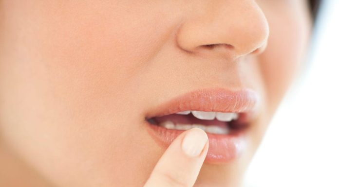 Cum recunoști herpesul oral încă de la primele semne?